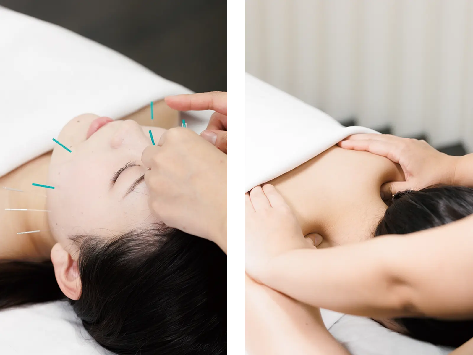 訪問型美容鍼灸整体サロン